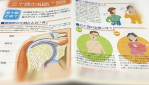 五十肩